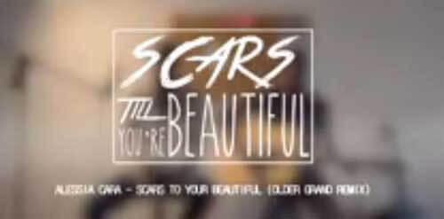 Alessia Cara - Scars To Your Beautiful (Older Grand Remix)